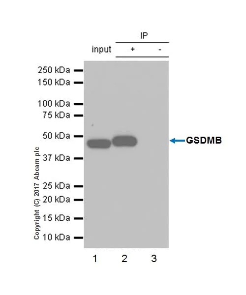 Immunoprecipitation - Anti-GSDMB antibody [EPR20841] - BSA and Azide free (AB226483)