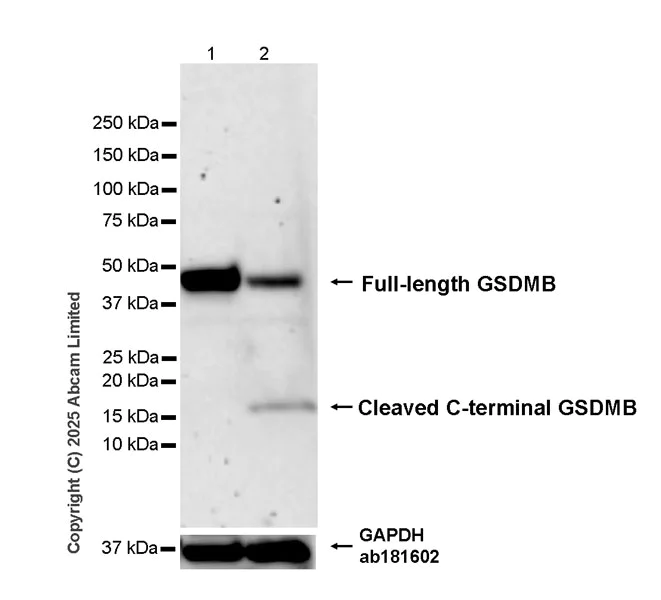 Western blot - Anti-GSDMB (C-term) antibody [EPR24636-120] (AB325491)