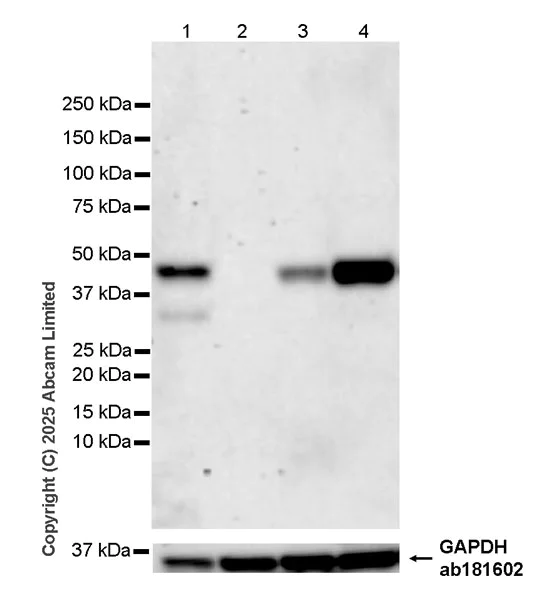 Western blot - Anti-GSDMB (C-term) antibody [EPR24636-120] (AB325491)