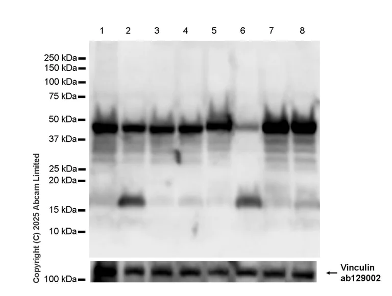 Western blot - Anti-GSDMB (C-term) antibody [EPR24636-120] (AB325491)