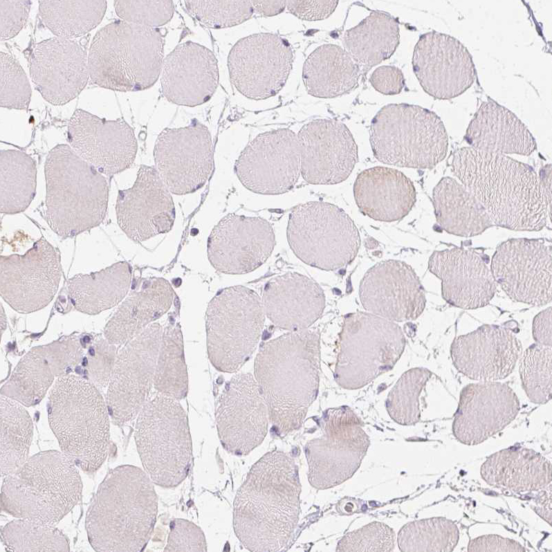 Immunohistochemistry (Formalin/PFA-fixed paraffin-embedded sections) - Anti-GSDMC antibody (AB254813)