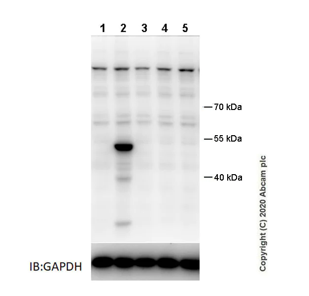 Western blot - Anti-GSDMC antibody [EPR20887-50] (AB225635)