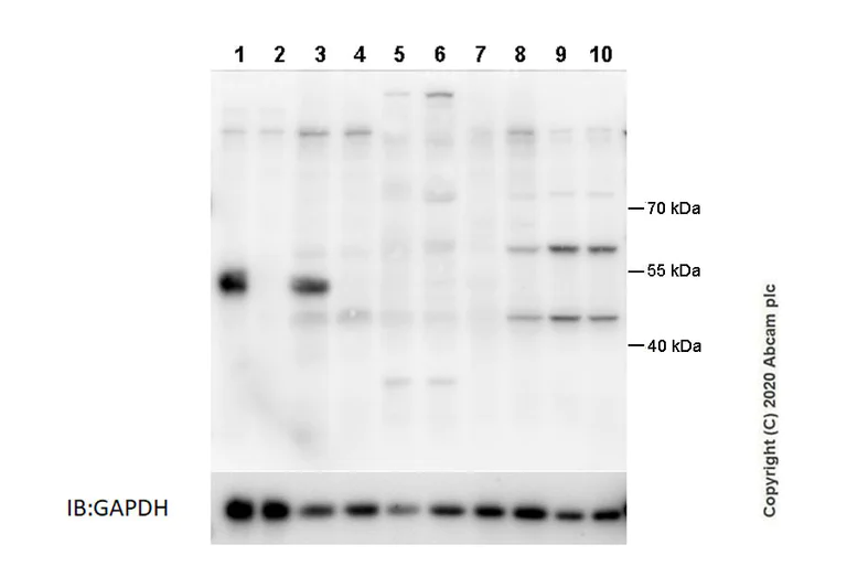 Western blot - Anti-GSDMC antibody [EPR20887-50] (AB225635)