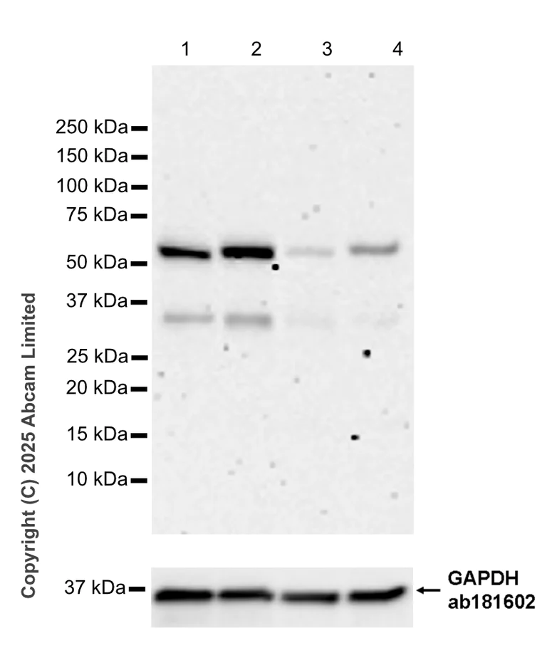 Western blot - Anti-GSDMC antibody [EPR24215-8] (AB325524)