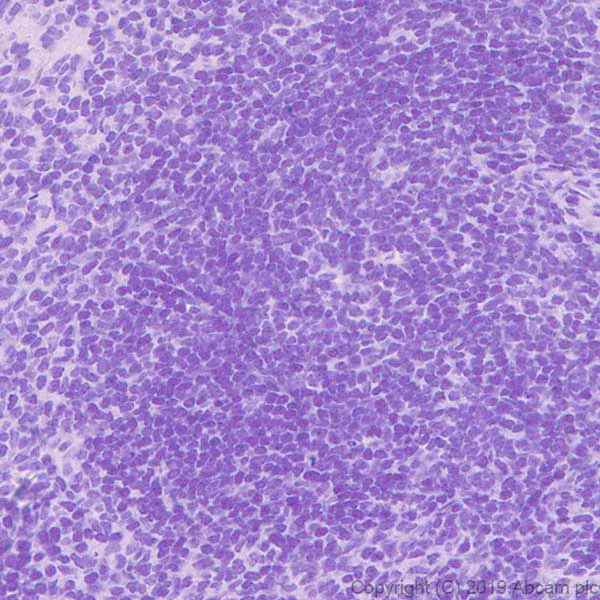 Immunohistochemistry (Formalin/PFA-fixed paraffin-embedded sections) - Anti-GSDMC2 + GSDMC3 antibody [EPR20890-48] (AB229896)