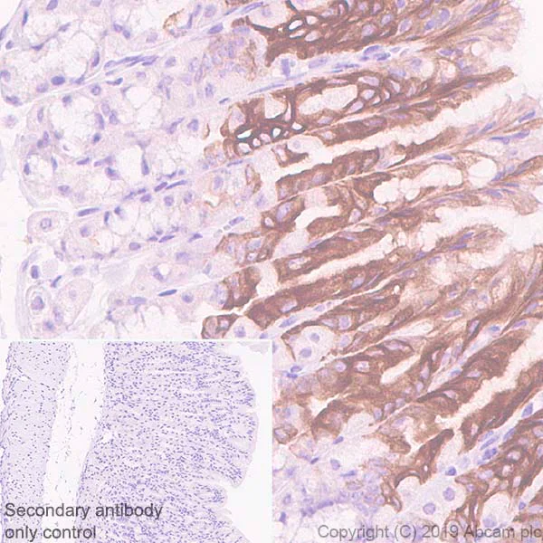 Immunohistochemistry (Formalin/PFA-fixed paraffin-embedded sections) - Anti-GSDMC2 + GSDMC3 antibody [EPR20890-48] (AB229896)