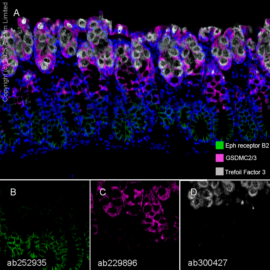 Multiplex immunohistochemistry - Anti-GSDMC2 + GSDMC3 antibody [EPR20890-48] (ab229896), expandable thumbnail