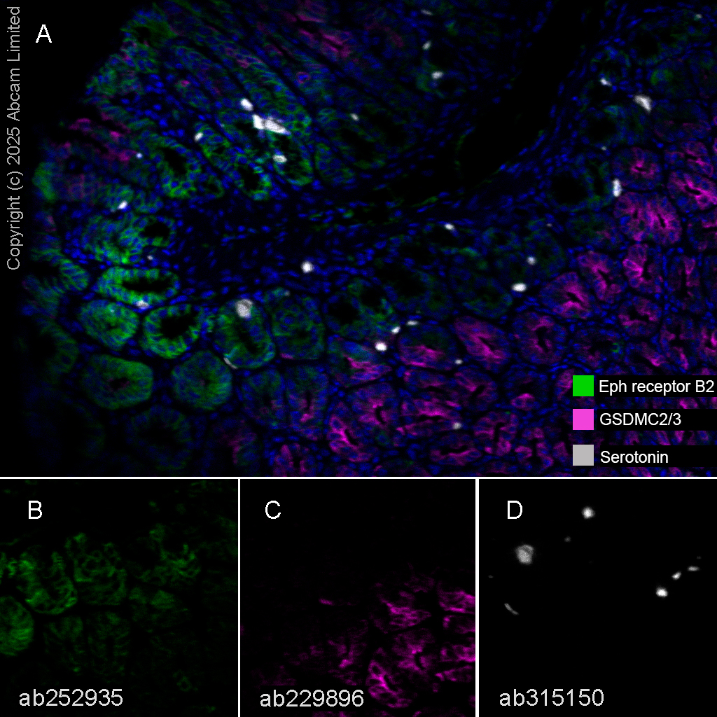 Multiplex immunohistochemistry - Anti-GSDMC2 + GSDMC3 antibody [EPR20890-48] (ab229896), expandable thumbnail