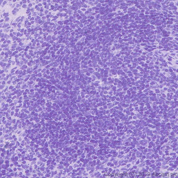 Immunohistochemistry (Formalin/PFA-fixed paraffin-embedded sections) - Anti-GSDMC2 + GSDMC3 antibody [EPR20890-48] - BSA and Azide free (ab269859), expandable thumbnail