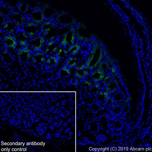 Immunohistochemistry (Frozen sections) - Anti-GSDMC2 + GSDMC3 antibody [EPR20890-48] - BSA and Azide free (AB269859), expandable thumbnail