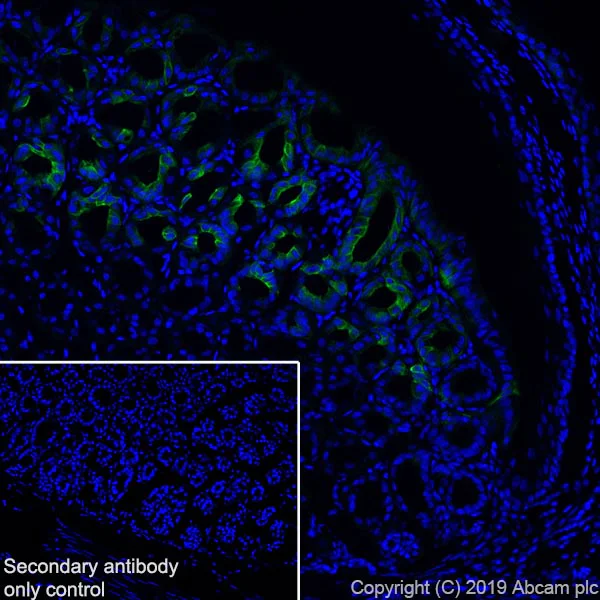 Immunohistochemistry (Frozen sections) - Anti-GSDMC2 + GSDMC3 antibody [EPR20890-48] - BSA and Azide free (AB269859)