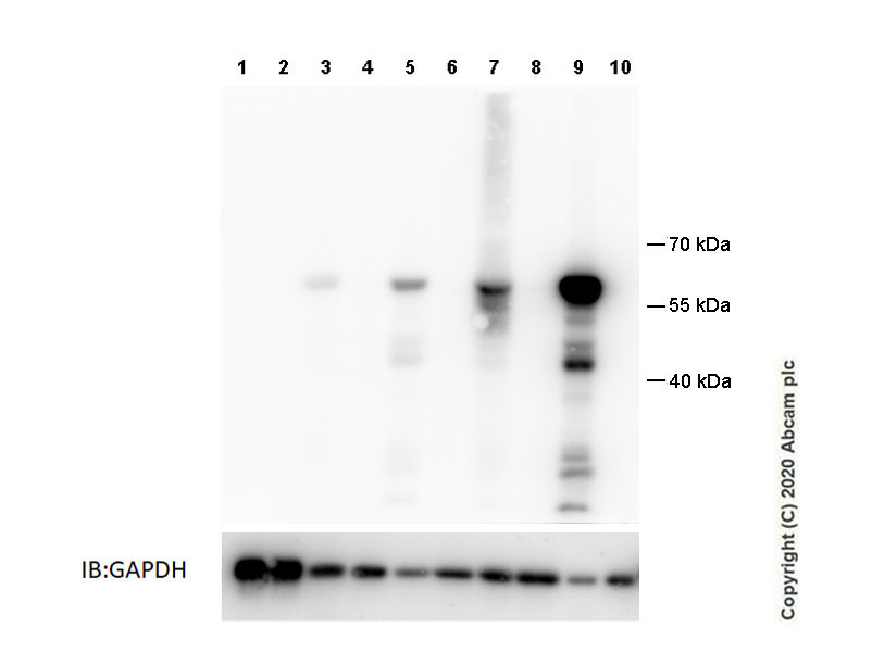 Western blot - Anti-GSDMC2 + GSDMC3 antibody [EPR20890-48] - BSA and Azide free (AB269859), expandable thumbnail