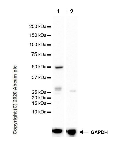 Western blot - Anti-GSDMC2 + GSDMC3 antibody [EPR20890-48] - BSA and Azide free (AB269859), expandable thumbnail