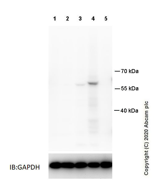 Western blot - Anti-GSDMC2 + GSDMC3 antibody [EPR20890-48] - BSA and Azide free (ab269859), expandable thumbnail