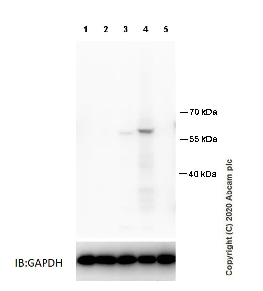Western blot - Anti-GSDMC2 + GSDMC3 antibody [EPR20890-48] - BSA and Azide free (AB269859)
