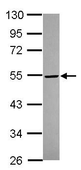 Western blot - Anti-GSDMD antibody (AB155233)
