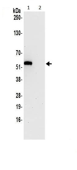 Immunoprecipitation - Anti-GSDMD antibody - C-terminal (AB228824)