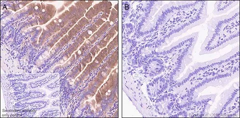 Immunohistochemistry (Formalin/PFA-fixed paraffin-embedded sections) - Anti-GSDMD antibody [EPR20859] (AB219800)