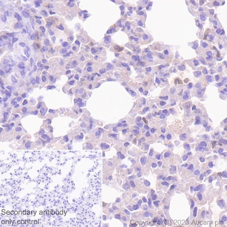 Immunohistochemistry (Formalin/PFA-fixed paraffin-embedded sections) - Anti-GSDMD antibody [EPR20859] (AB219800)