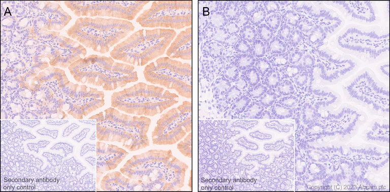Immunohistochemistry (Formalin/PFA-fixed paraffin-embedded sections) - Anti-GSDMD antibody [EPR20859] - BSA and Azide free (AB239377)