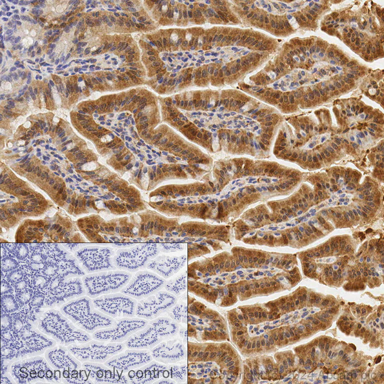 Immunohistochemistry (Formalin/PFA-fixed paraffin-embedded sections) - Anti-GSDMD antibody [EPR20859] - BSA and Azide free (AB239377)