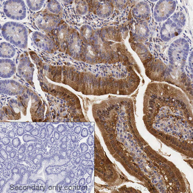 Immunohistochemistry (Formalin/PFA-fixed paraffin-embedded sections) - Anti-GSDMD antibody [EPR20859] - BSA and Azide free (AB239377)