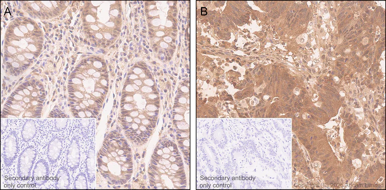 Immunohistochemistry (Formalin/PFA-fixed paraffin-embedded sections) - Anti-GSDMD antibody [EPR30356-588] (AB324385)