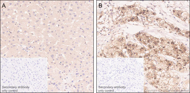 Immunohistochemistry (Formalin/PFA-fixed paraffin-embedded sections) - Anti-GSDMD antibody [EPR30356-588] (AB324385)