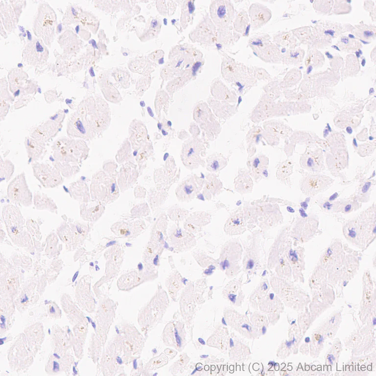 Immunohistochemistry (Formalin/PFA-fixed paraffin-embedded sections) - Anti-GSDMD antibody [EPR30356-588] (AB324385)