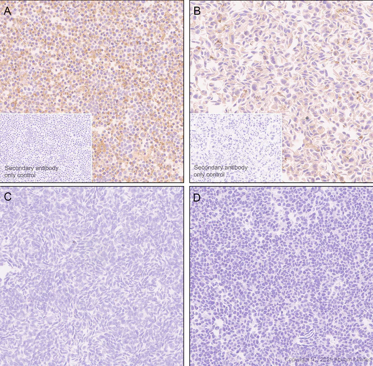 Immunohistochemistry (Formalin/PFA-fixed paraffin-embedded sections) - Anti-GSDMD antibody [EPR30356-588] (AB324385)