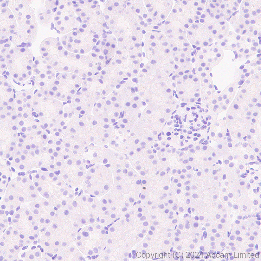 Immunohistochemistry (Formalin/PFA-fixed paraffin-embedded sections) - Anti-GSH2 antibody [EPR29122-65] - BSA and Azide free (AB321995), expandable thumbnail