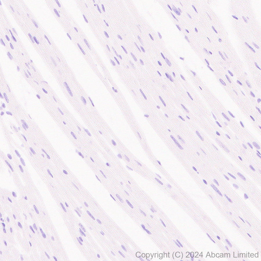 Immunohistochemistry (Formalin/PFA-fixed paraffin-embedded sections) - Anti-GSH2 antibody [EPR29122-65] - BSA and Azide free (AB321995), expandable thumbnail