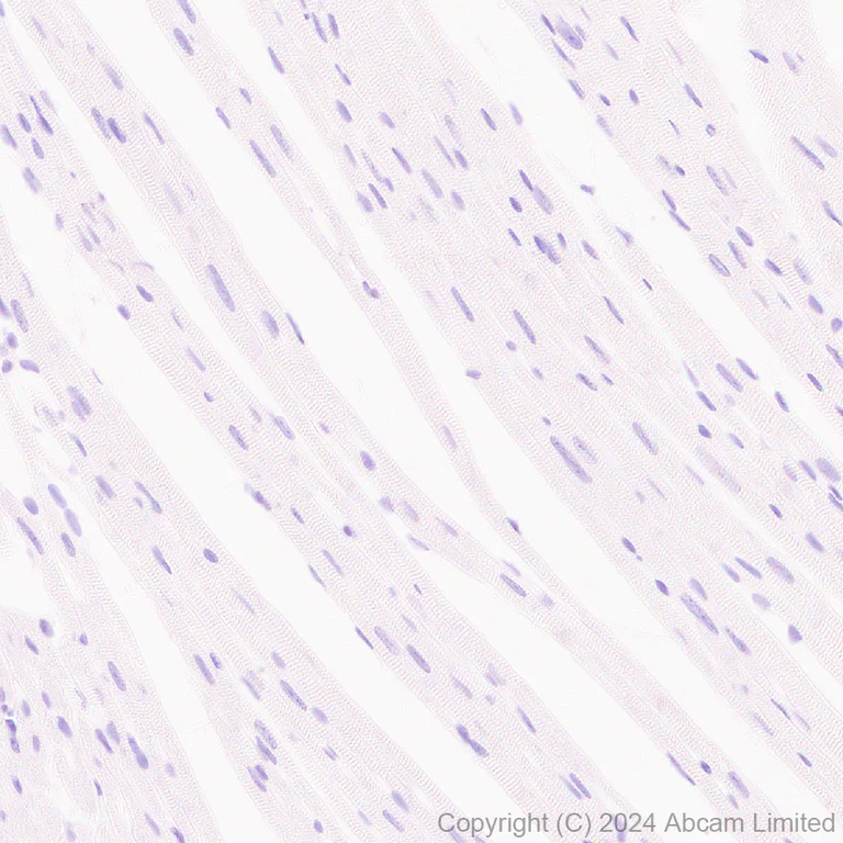 Immunohistochemistry (Formalin/PFA-fixed paraffin-embedded sections) - Anti-GSH2 antibody [EPR29122-65] - BSA and Azide free (AB321995)