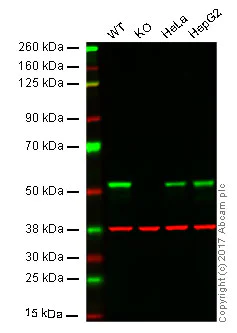 Western blot - Anti-GSK3 alpha antibody [EP793Y] (AB40870)