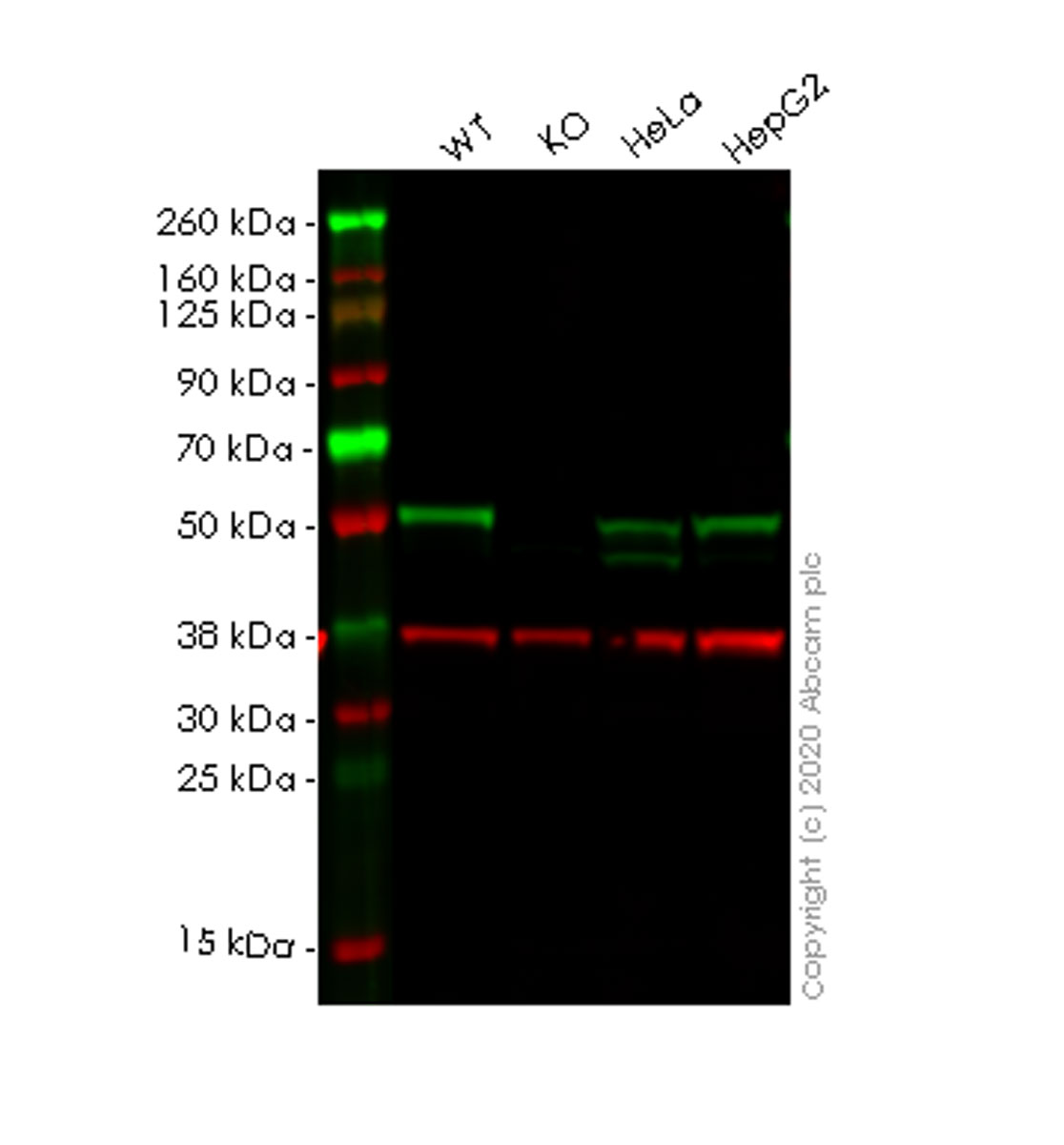 Western blot - Anti-GSK3 alpha antibody [EP793Y] (AB40870)