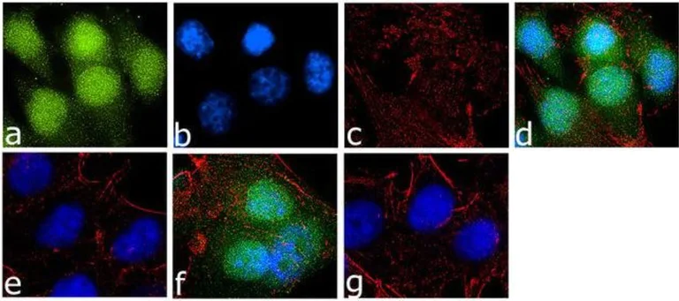 Immunocytochemistry - Anti-GSK3 (alpha + beta) (phospho Y216 + Y279) antibody [19HCLC] (AB277777)