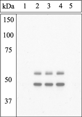 Western blot - Anti-GSK3 (alpha + beta) (phospho Y216 + Y279) antibody (AB4797)
