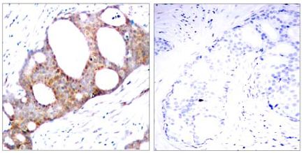 Immunohistochemistry (Formalin/PFA-fixed paraffin-embedded sections) - Anti-GSK3 alpha (phospho S21) antibody (AB131112)