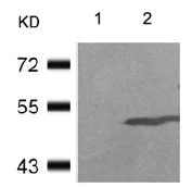 Western blot - Anti-GSK3 alpha (phospho S21) antibody (AB131112)