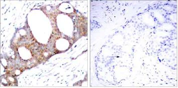Immunohistochemistry (Formalin/PFA-fixed paraffin-embedded sections) - Anti-GSK3 alpha (phospho S21) antibody (AB28808)