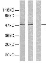 Western blot - Anti-GSK3 alpha (phospho S21) antibody (AB28808)