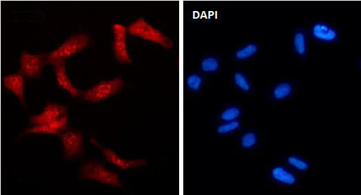 Immunocytochemistry/ Immunofluorescence - Anti-GSK3 alpha (phospho Y216) + GSK3 beta (phospho Y279) antibody [SR1908] (AB326657)