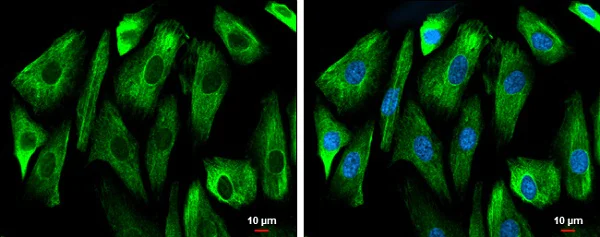 Immunocytochemistry/ Immunofluorescence - Anti-GSK3 beta antibody (AB227208)