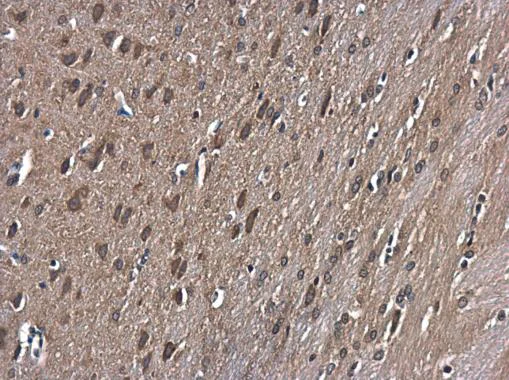 Immunohistochemistry (Formalin/PFA-fixed paraffin-embedded sections) - Anti-GSK3 beta antibody (AB227208)