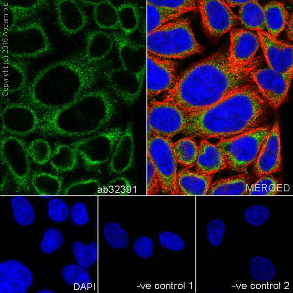 Immunocytochemistry/ Immunofluorescence - Anti-GSK3 beta antibody [Y174] (AB32391), expandable thumbnail