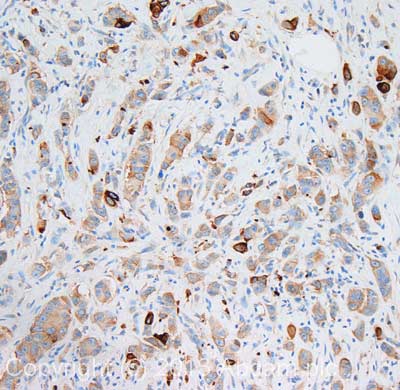 Immunohistochemistry (Formalin/PFA-fixed paraffin-embedded sections) - Anti-GSK3 beta antibody [Y174] - BSA and Azide free (AB183177)