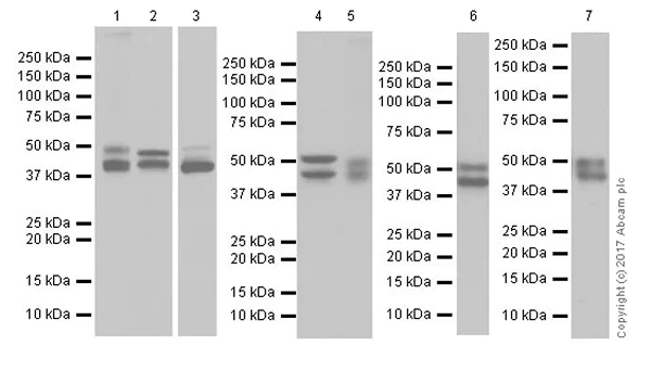 Western blot - Anti-GSK3 beta + GSK3 alpha antibody [EPR18814-102] (AB185141)