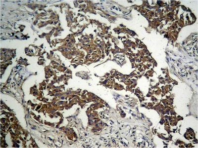 Immunohistochemistry (Formalin/PFA-fixed paraffin-embedded sections) - Anti-GSK3 beta (phospho S9) antibody (AB131097)