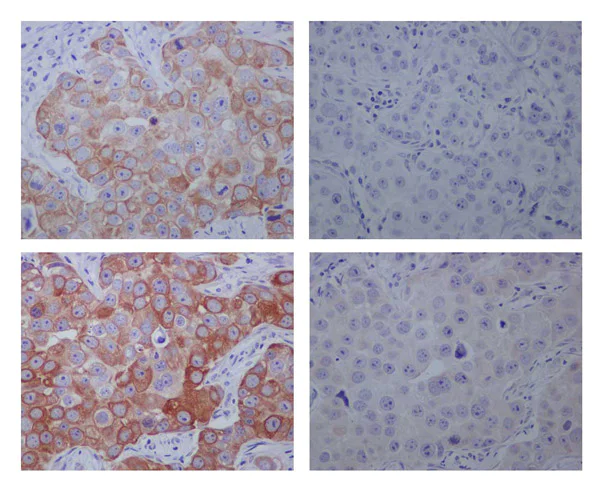 Immunohistochemistry (Formalin/PFA-fixed paraffin-embedded sections) - Anti-GSK3 beta (phospho S9) antibody [EPR2286Y] (AB75814)