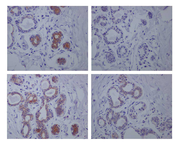 Immunohistochemistry (Formalin/PFA-fixed paraffin-embedded sections) - Anti-GSK3 beta (phospho S9) antibody [EPR2286Y] (ab75814), expandable thumbnail